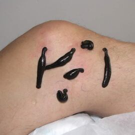 Blutegel-Therapie Blutegel Arthrose-Knie
