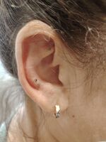 Schmerztherapie Rochlitz bei steifem Nacken und Lendenwirbelproblemen - Ohrakupunktur mit Dauernadeln